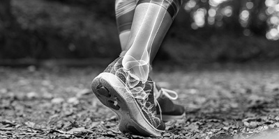 Sports injury rehabilitation clinic durham sunderland